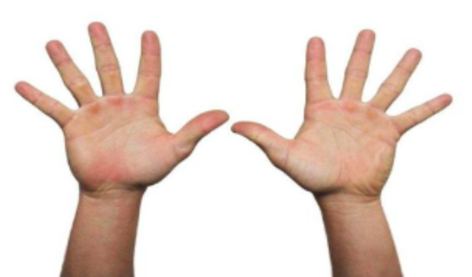 手指10个螺是什么命 手指10个螺纹代表什么意思
