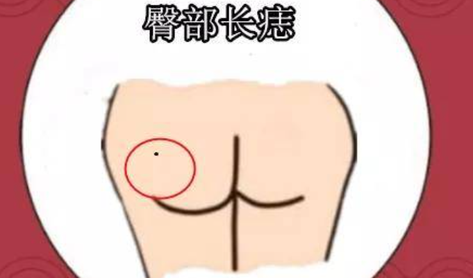 臀部痣的位置与命运图 臀部长痣什么寓意